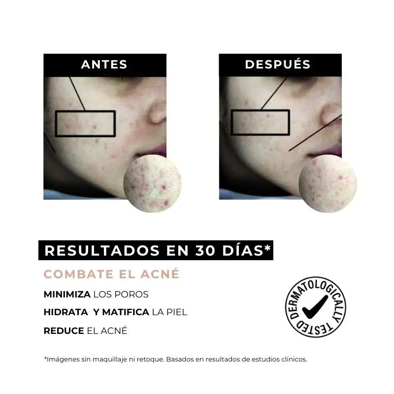 Arganour Facial Equilibrium Κρέμα κατά της ακμής, 50 ml