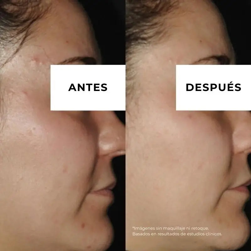 Arganour Facial Equilibrium Κρέμα κατά της ακμής, 50 ml