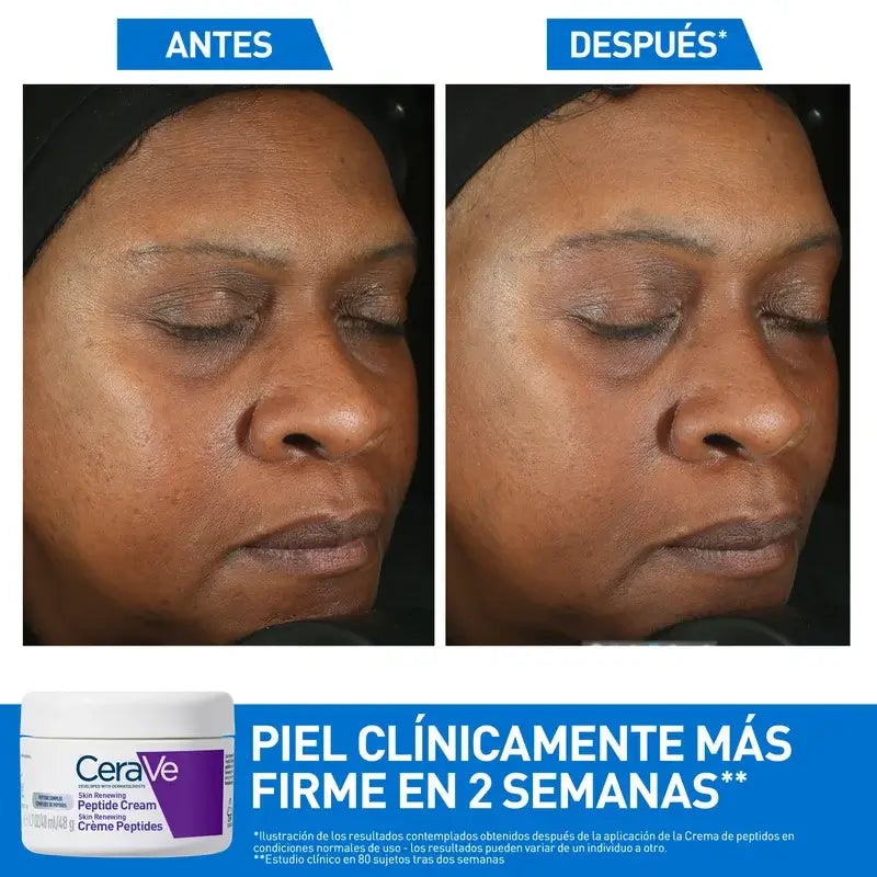 Cerave Skin Renewing Κρέμα με πεπτίδια, 48 ml