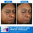 Cerave Skin Renewing Κρέμα με πεπτίδια, 48 ml