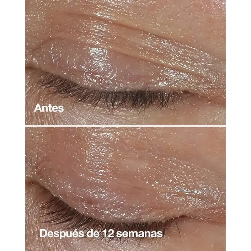 Clinique Smart Αντιγηραντική Κρέμα για τα Μάτια, 15 ml