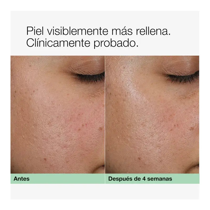 Clinique Smart Clinical Repair Κρέμα με κολλαγόνο + PDRN, 50 ml