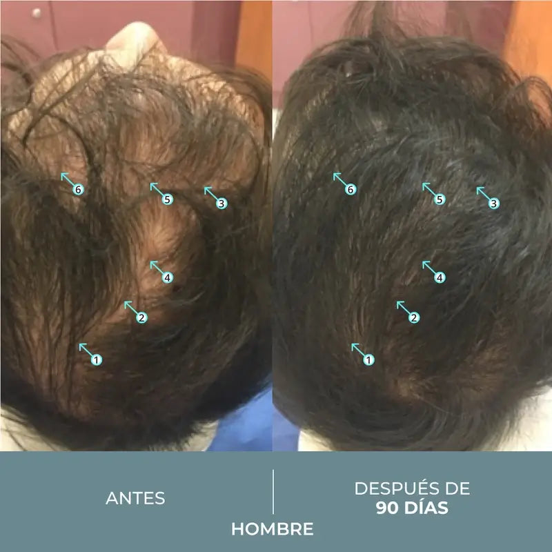 Ds Laboratories Revita Sod Δισκία κατά της τριχόπτωσης, 30 τεμ.