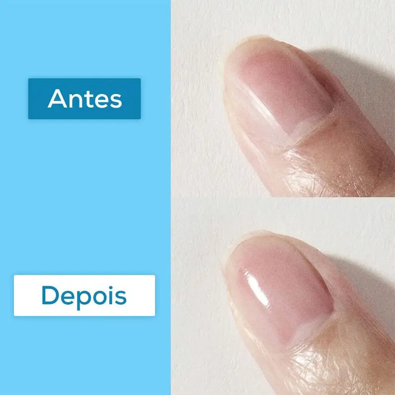 Essie Hard To Resist Advanced, Θεραπεία ενίσχυσης των νυχιών, Τεχνολογία MSM, Διαφανές