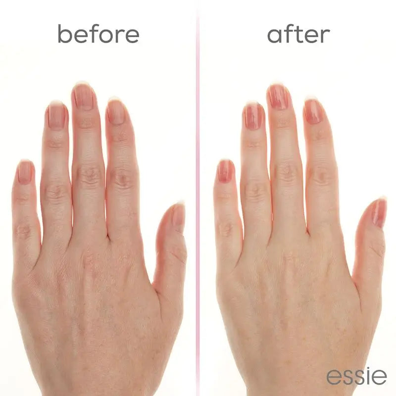 Essie Hard To Resist, Θεραπεία ενίσχυσης νυχιών, Ροζ