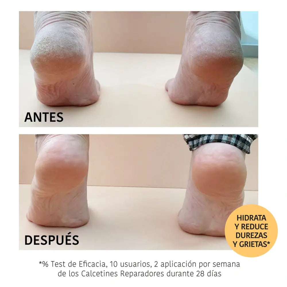 Iroha Nature Corporal Κάλτσες Μάσκα Αναζωογόνησης, 20 ml