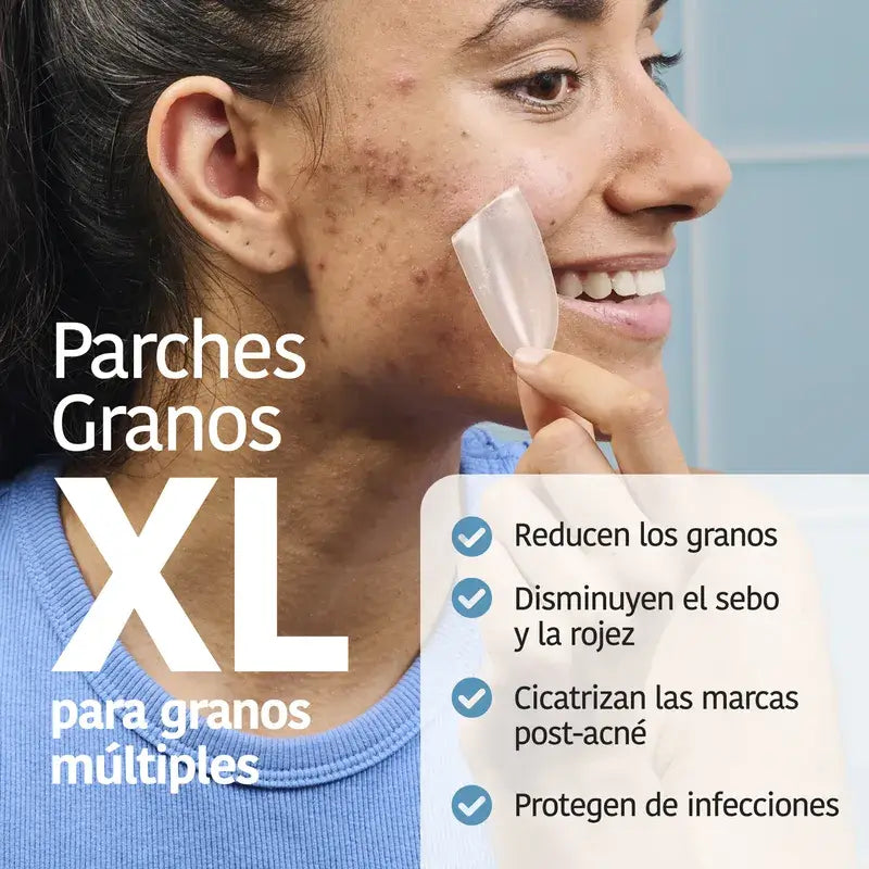 Iroha Nature Xl Pimple Patch, 5 τεμάχια
