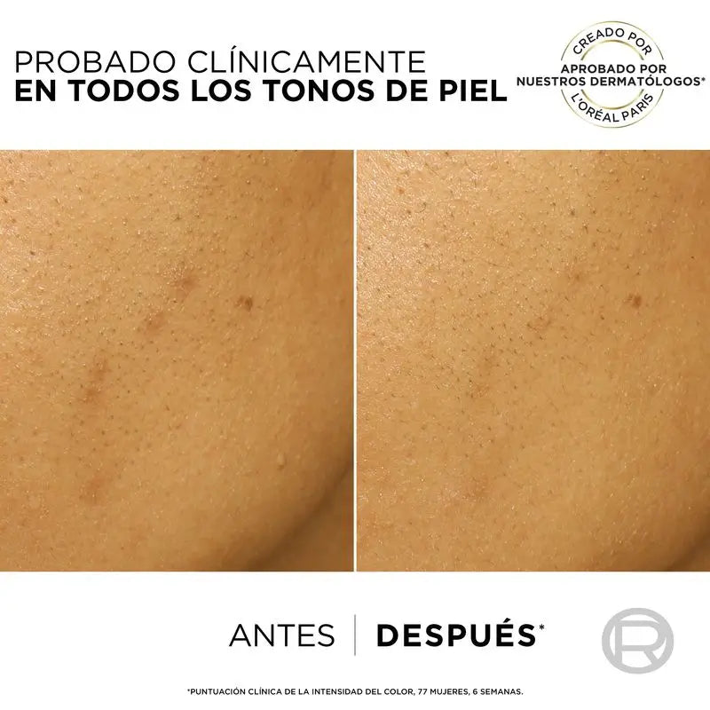 L'Oréal Paris Bright Reveal Peeling – Απολεπιστικό κατά των κηλίδων