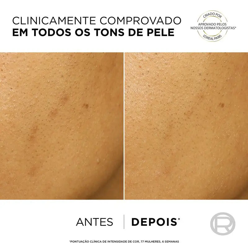 L'Oréal Paris Bright Reveal Peeling – Απολεπιστικό κατά των κηλίδων