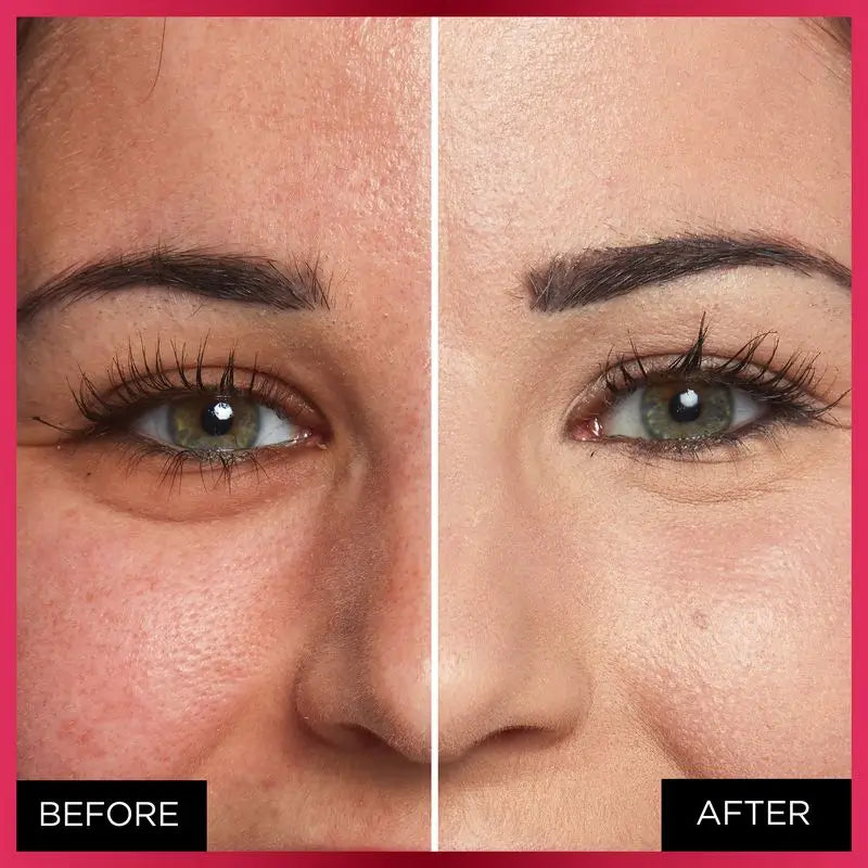 L'Oréal Paris Infalible More Than Concealer Κονσίλερ Πλήρης Κάλυψη, Απόχρωση 325 Bisque/Bisque, 11 ml