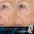 Medik8 Retinal Rewind Crystal Retinal 3 30 ml + Crystal Retinal Ceramide 3 15 ml