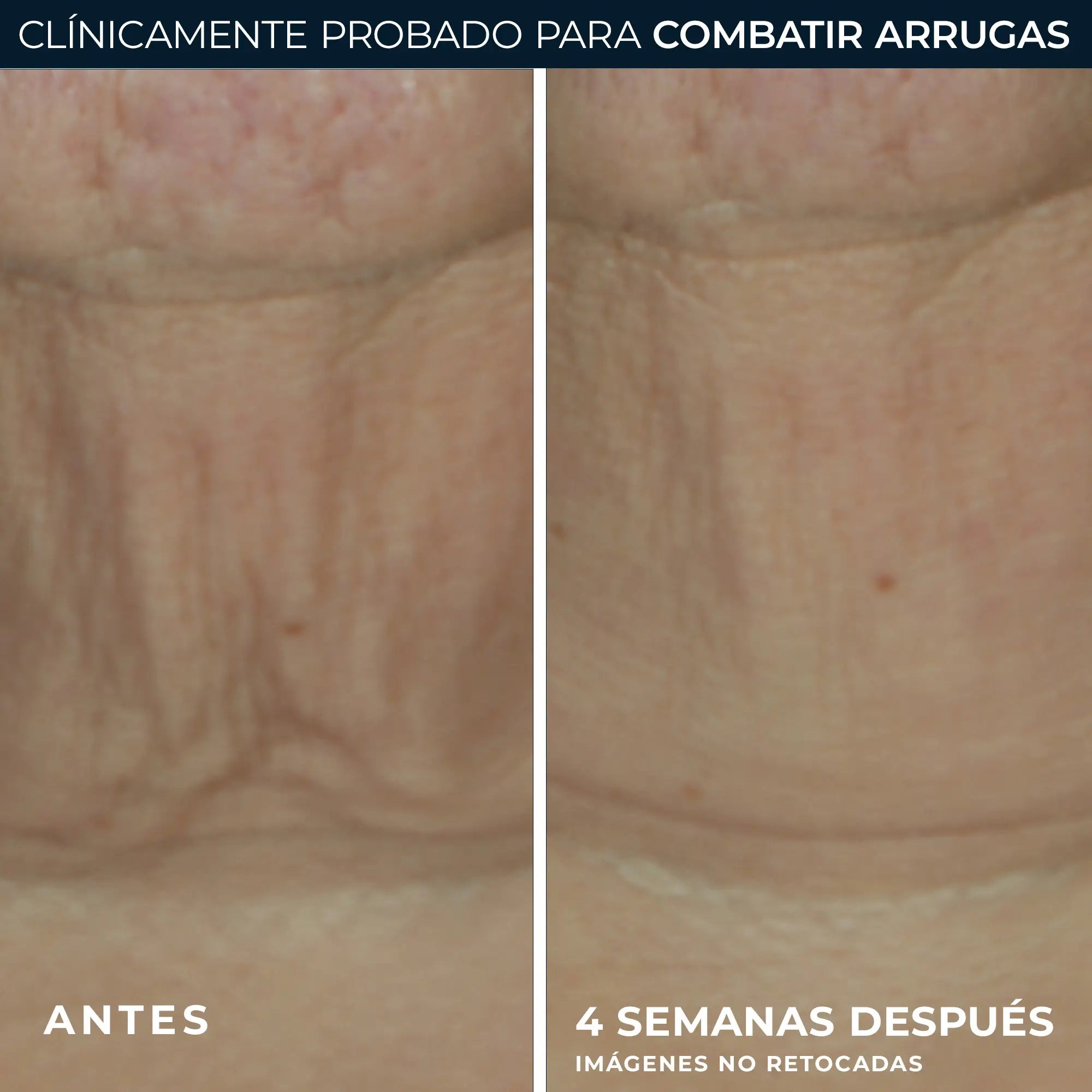 Roc Skincare Iberia Roc® Derm Correxion® Στικ σύσφιξης 30G