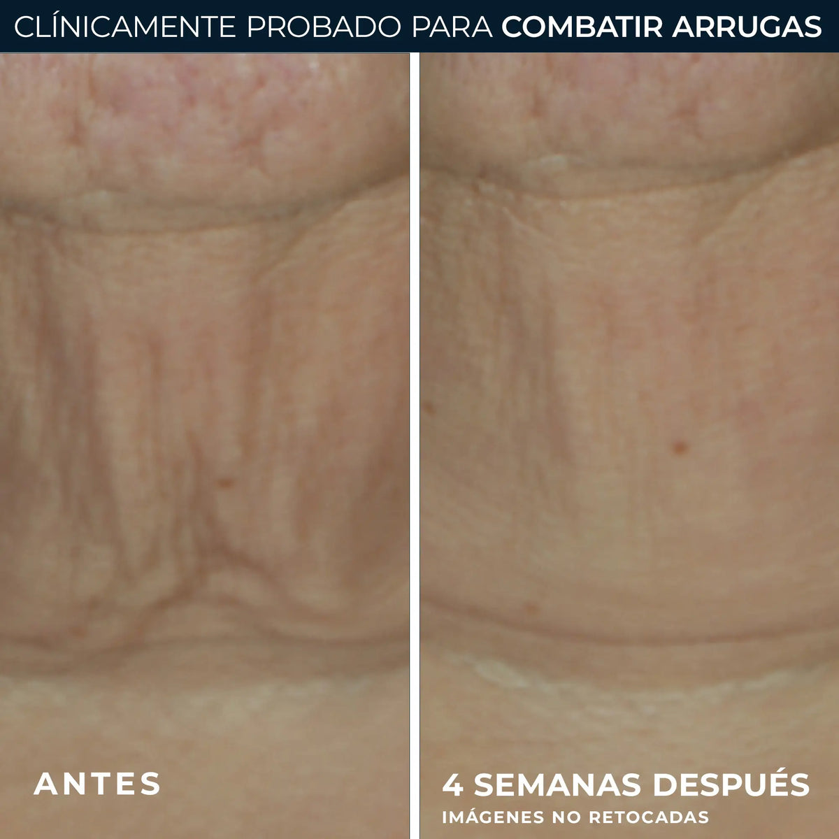 Roc Skincare Iberia Roc® Derm Correxion® Στικ σύσφιξης 30G