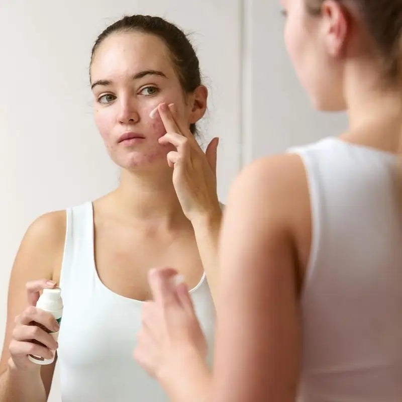 Vincobiosis Cremigel για το πρόσωπο, για την εξισορρόπηση του δέρματος, 50 ml